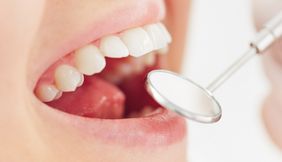 Preventing cavities and improving oral health