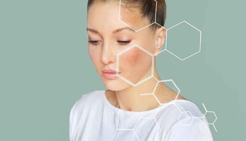 Problemas en la piel a causa del estrés