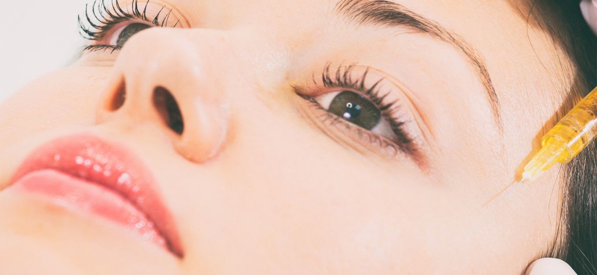 ¿Ojeras? Te decimos cómo combatirlas