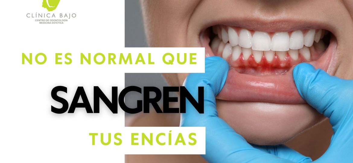 Why are your gums bleeding?